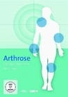 Arthrose: Genkschmerzen - Was nun?