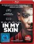 In my Skin